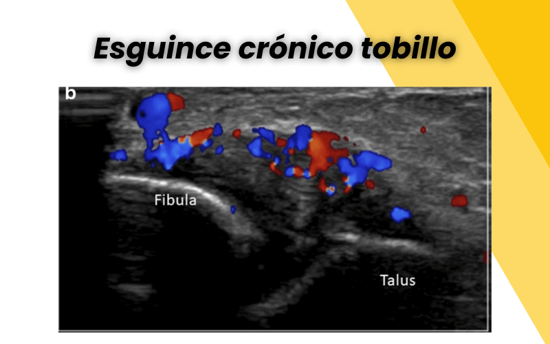 10. Lesiones ecografia genero tempo formacion.png